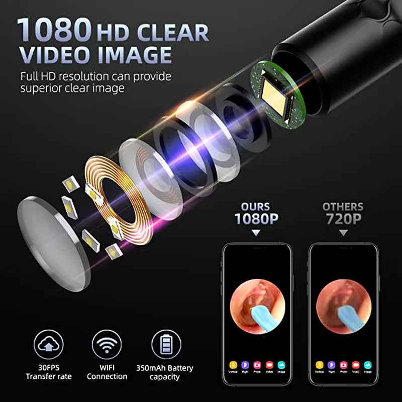 Ear Wax Cleaner Remover with Otoscope Camera Wireless Otoscope Ear Cleaner Ear Wax Removal